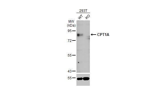 CPT1A Antibody (HL1164) - Azide and BSA Free