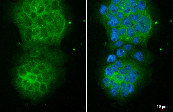 CYLD Antibody (HL1260) - Azide and BSA Free