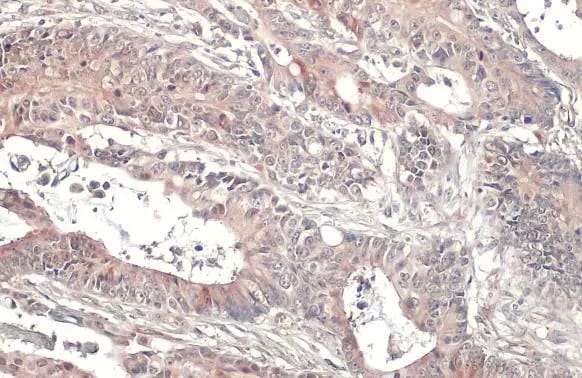 CYLD Antibody (HL1260) - Azide and BSA Free