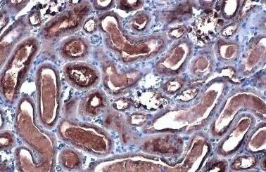 CYP27A1 Antibody (HL1819) - Azide and BSA Free