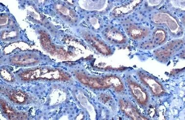 CYP27A1 Antibody (HL1820) - Azide and BSA Free