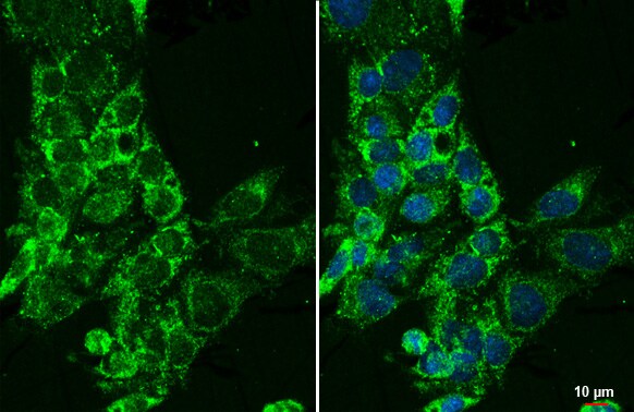 CYP27A1 Antibody (HL1820) - Azide and BSA Free