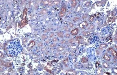 CYP27A1 Antibody (HL1820) - Azide and BSA Free