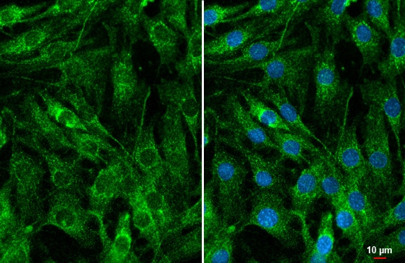 Cyr61/CCN1 Antibody (HL2144) - Azide and BSA Free