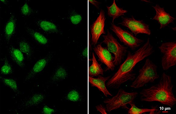 DNA Ligase III Antibody (HL2280) - Azide and BSA Free