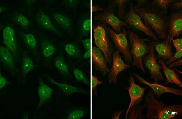dUTPase Antibody (HL1210) - Azide and BSA Free