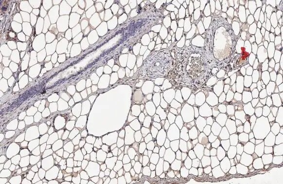 Monoglyceride Lipase Antibody (HL1938) - Azide and BSA Free