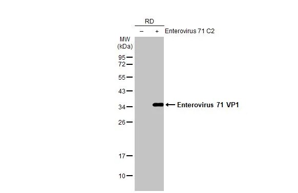 Enterovirus 71 VP1 Antibody (HL1928) - Azide and BSA Free