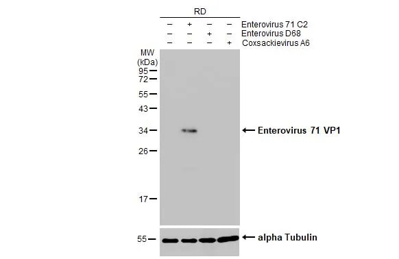 Enterovirus 71 VP1 Antibody (HL1929) - Azide and BSA Free