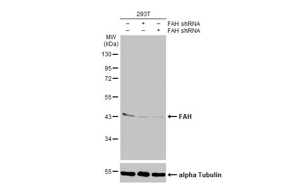 Fumarylacetoacetate hydrolase Antibody (HL1970) - Azide and BSA Free