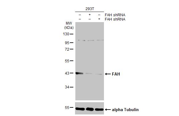 Fumarylacetoacetate hydrolase Antibody (HL1972) - Azide and BSA Free