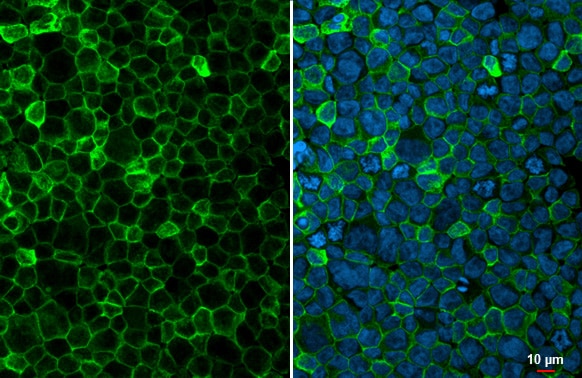 FCER1G Antibody (HL1418) - Azide and BSA Free