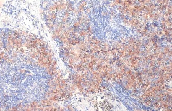 FCER1G Antibody (HL1418) - Azide and BSA Free
