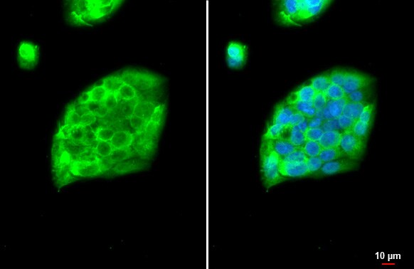 Fibrinogen gamma chain Antibody (HL1395) - Azide and BSA Free