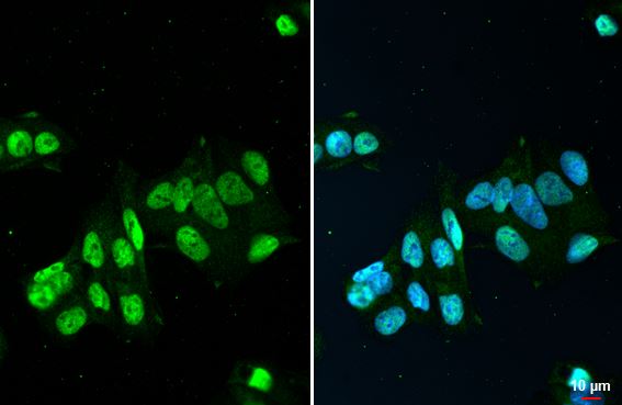 FUS Antibody (HL2454) - Azide and BSA Free