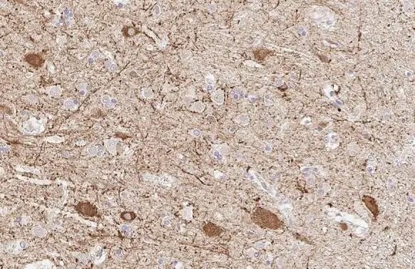 GAD1/GAD67 Antibody (HL1095) - Azide and BSA Free
