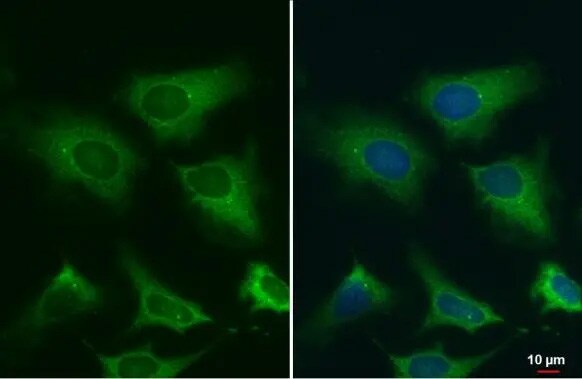 gamma Tubulin Antibody (HL1175) - Azide and BSA Free