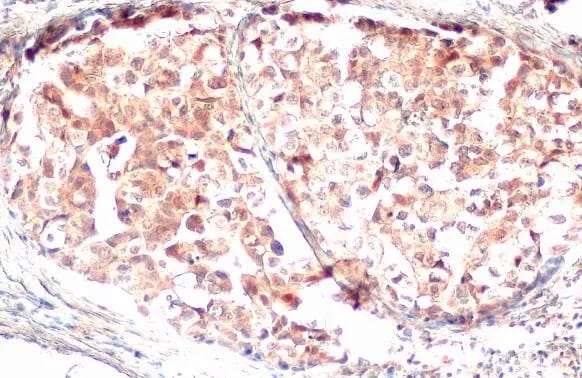 GSDMDC1 Antibody (HL1430) - Azide and BSA Free
