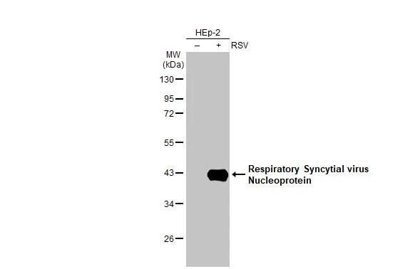 Respiratory Syncytial Virus Nucleoprotein Antibody (HL1296) - Azide and BSA Free
