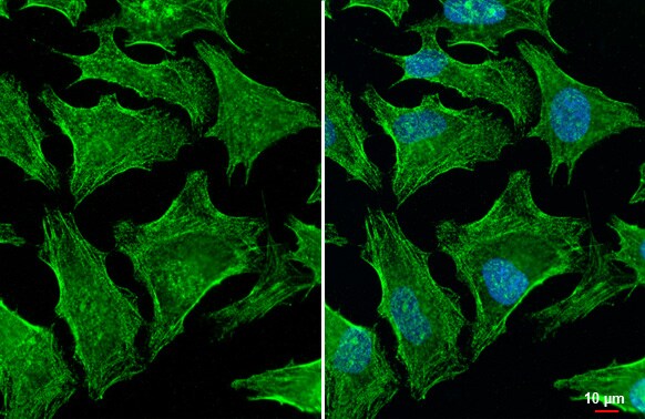Gelsolin/GSN Antibody (HL1930) - Azide and BSA Free