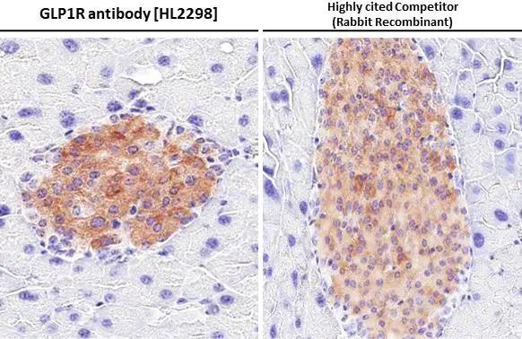 GLP-1R Antibody (HL2298) - Azide and BSA Free