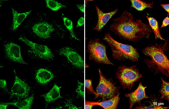 GRK2 Antibody (HL1562) - Azide and BSA Free