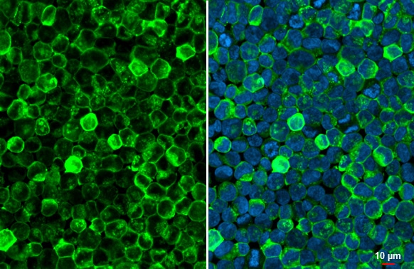 Hemoglobin epsilon Antibody (HL2457) - Azide and BSA Free