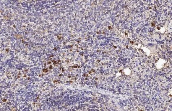 Hemoglobin epsilon Antibody (HL2457) - Azide and BSA Free