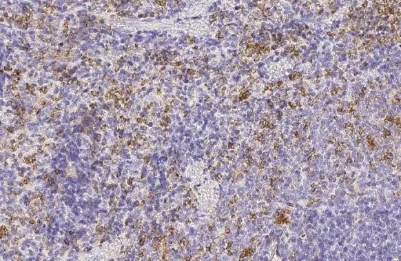 Hemoglobin epsilon Antibody (HL2458) - Azide and BSA Free