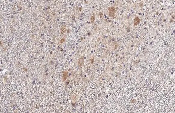 SDHB Antibody (HL2251) - Azide and BSA Free