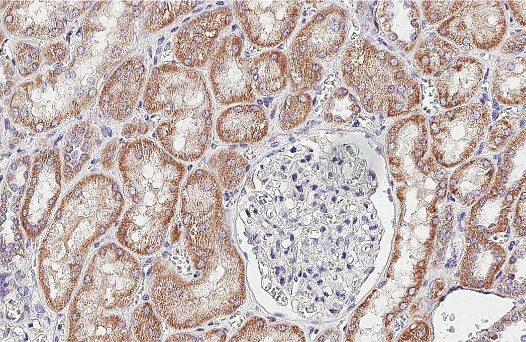 SDHB Antibody (HL2251) - Azide and BSA Free