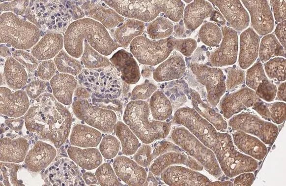 Hip Antibody (HL1969) - Azide and BSA Free