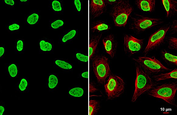 hnRNP A2B1 Antibody (HL1706) - Azide and BSA Free