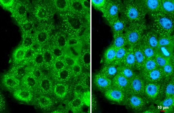HPV16 E7 Antibody (HL1647) - Azide and BSA Free