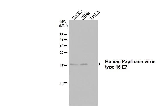HPV16 E7 Antibody (HL1821) - Azide and BSA Free