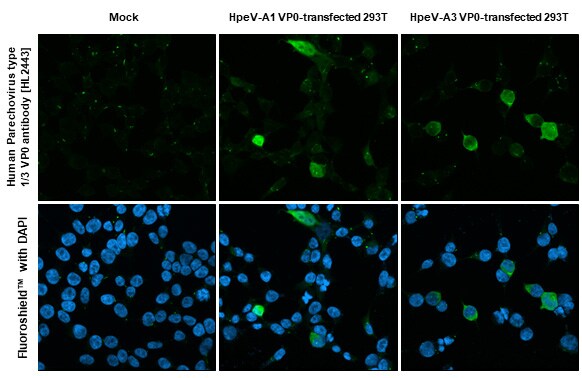 Human Parechovirus 1/3 VP0 Antibody (HL2443) - Azide and BSA Free