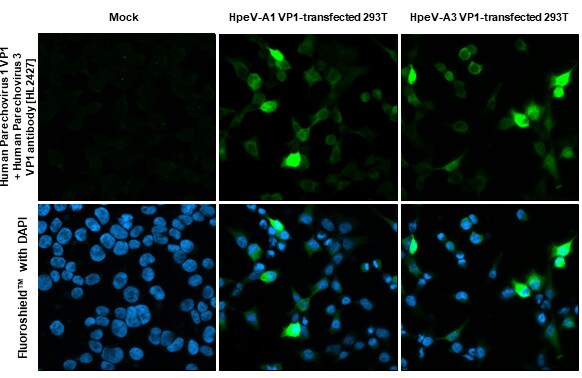 Human Parechovirus 1/3 VP1 Antibody (HL2427) - Azide and BSA Free