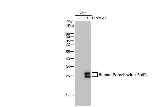 Human Parechovirus 1/3 VP1 Antibody (HL2427) - Azide and BSA Free