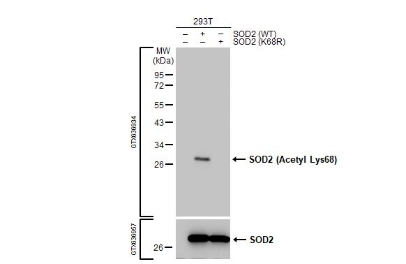 SOD2/Mn-SOD [ac Lys68] Antibody (HL1460) - Azide and BSA Free