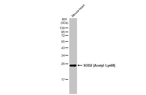 SOD2/Mn-SOD [ac Lys68] Antibody (HL1460) - Azide and BSA Free