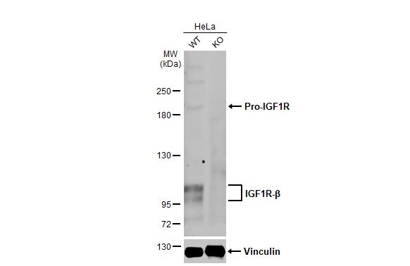 IGF-I R/IGF1R Antibody (HL1957) - Azide and BSA Free