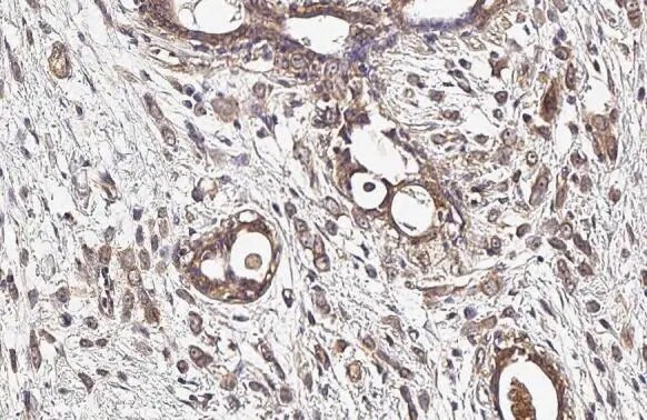 IGF-I R/IGF1R Antibody (HL1957) - Azide and BSA Free