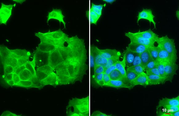 IGF-I R/IGF1R Antibody (HL1957) - Azide and BSA Free