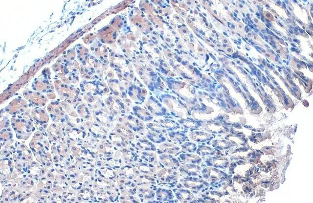 IKK gamma Antibody (HL1577) - Azide and BSA Free