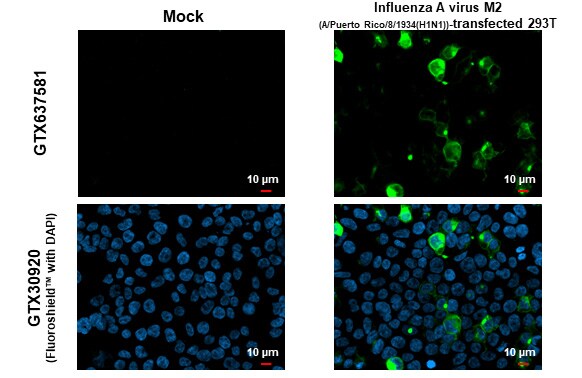 Influenza A H1N1 M2 Antibody (HL1856) - Azide and BSA Free