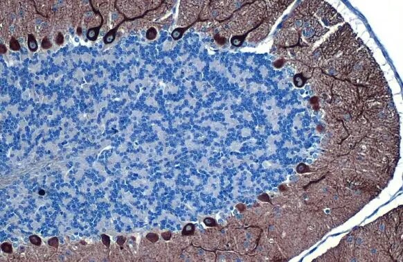 IP3R1 Antibody (HL1541) - Azide and BSA Free