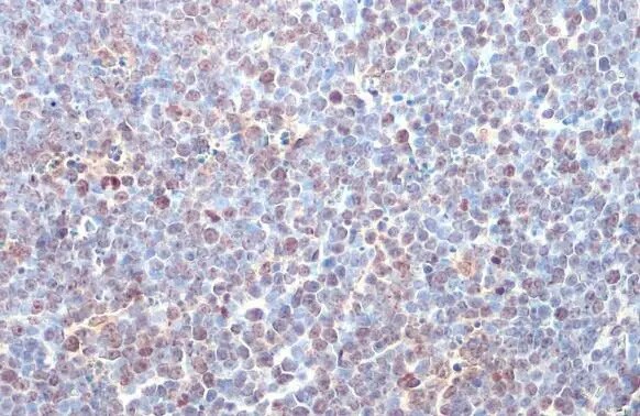 ITK Antibody (HL1264) - Azide and BSA Free