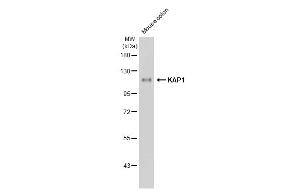 KAP1 Antibody (HL1539) - Azide and BSA Free
