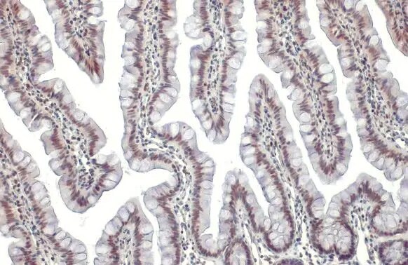 KAP1 Antibody (HL1539) - Azide and BSA Free
