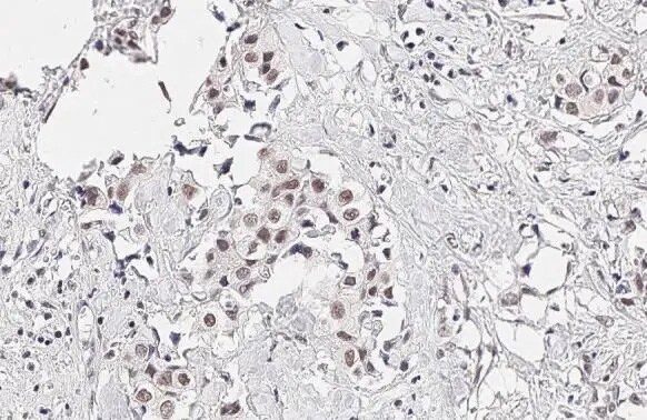 KDM6A Antibody (HL1731) - Azide and BSA Free